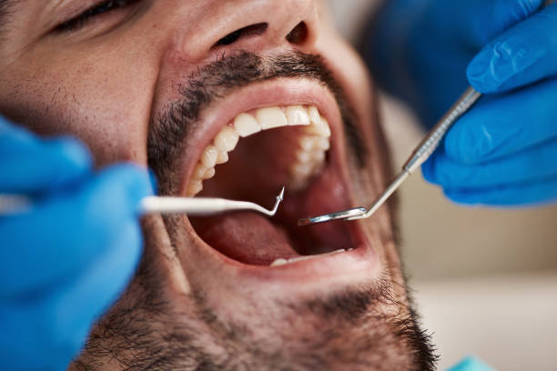 Best Pediatric Emergency Dentist in Linden, CA